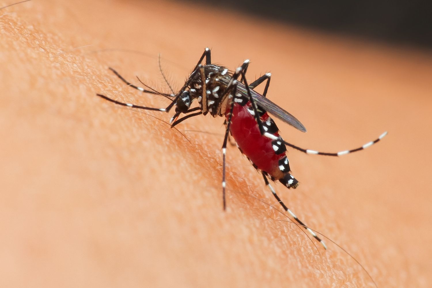 Dengue hemorrhagic fever