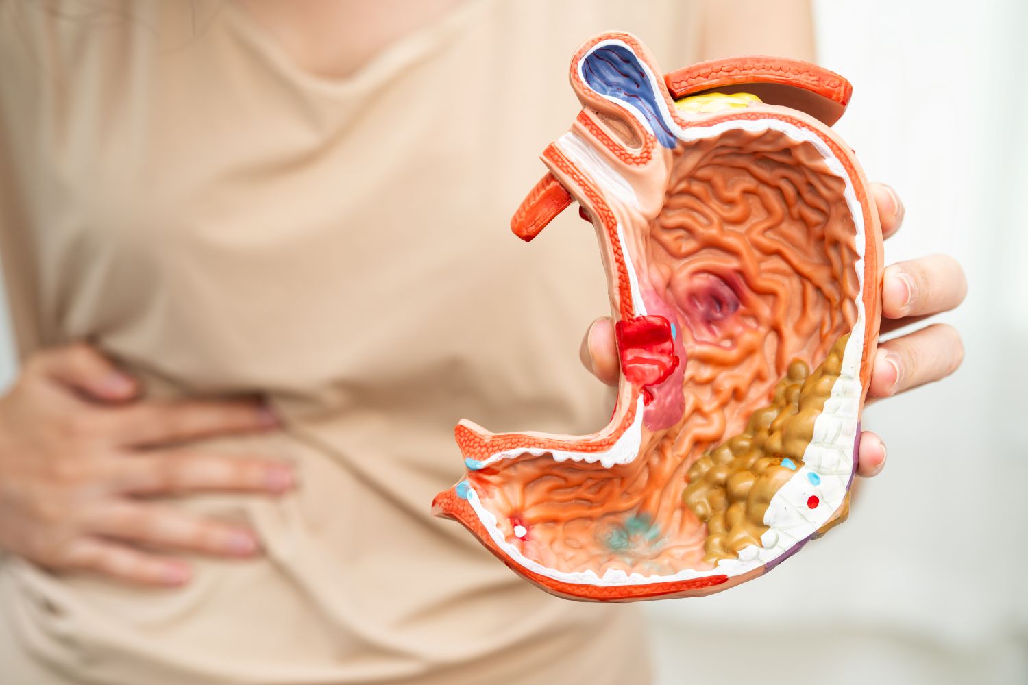 Stress-induced gastritis